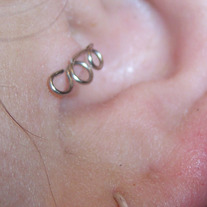 Triple loop T-Cuff