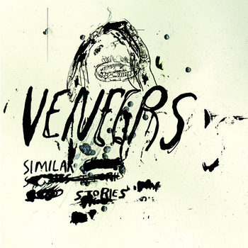 veneers 'similar stories' 12"